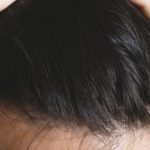毛周期(ヘアサイクル)の乱れは薄毛の原因|毛周期を正常にする方法