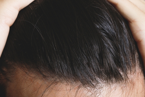 毛周期（ヘアサイクル）の乱れは薄毛の原因｜毛周期を正常にする方法