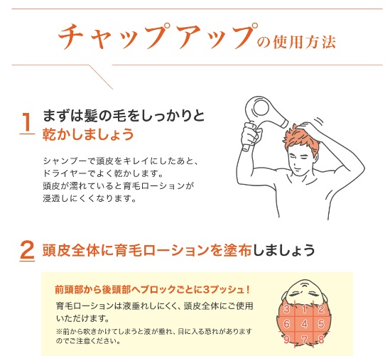 チャップアップ