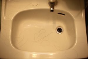 フケと抜け毛の関係性|フケは抜け毛を増加させ薄毛のリスクを高める